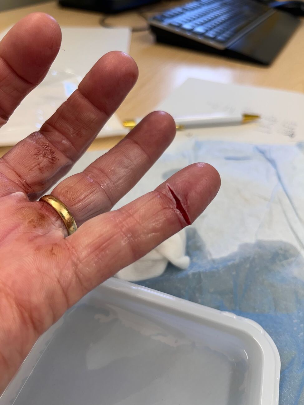 Hands marked by rope work
